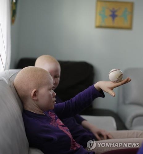 유엔 전문가 "말라위 백색증환자, 미신에 잇따라 희생" - 3