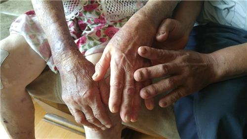 "日서 피폭돼 3대가 고통…70년 세월 외면당했다" - 2