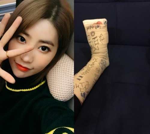 지난해 무대서 추락해 발목 깁스를 했던 다이아 기희현