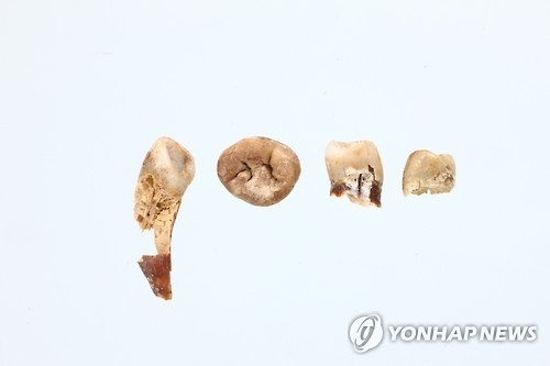 익산 쌍릉 대왕묘에서 나온 치아.