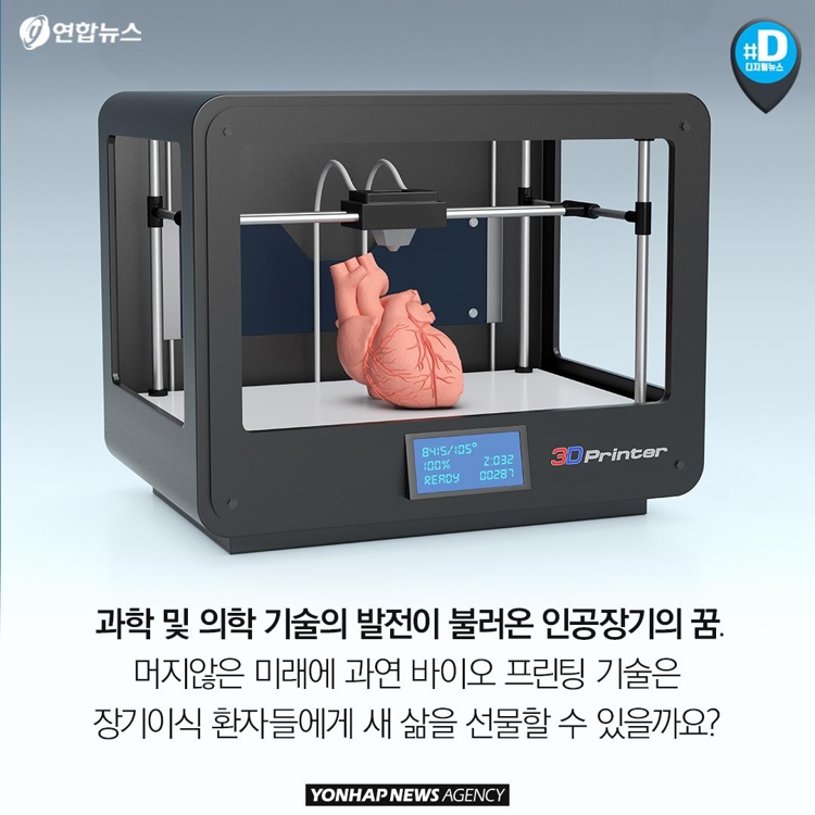 [카드뉴스] 혈관·뼈·내장 3D 프린팅 시대…장기이식 혁명 오나 - 13