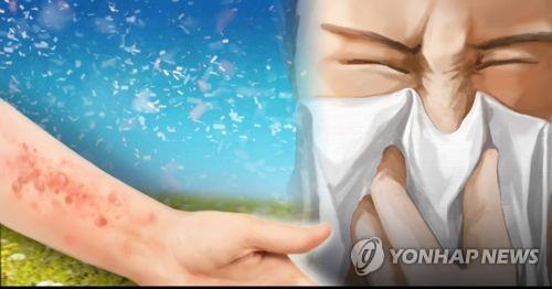 꽃가루 알레르기 (PG)