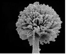 아플라톡신 생성 억제 토종 황국균 현미경 사진