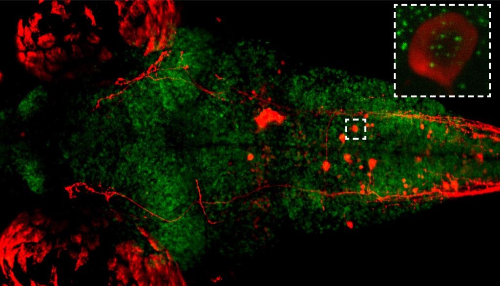 단일 신경세포(흰색 점선 안 빨간색)의 내 염색체 활동성(녹색 영상