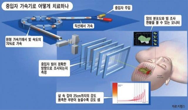 중입자가속기 치료 원리