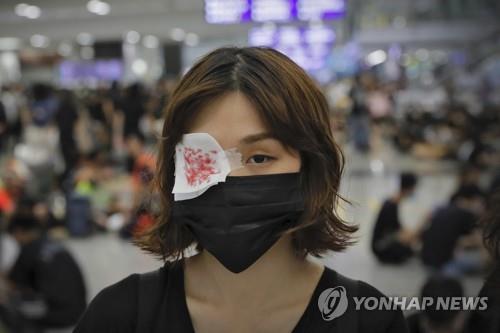 홍콩 시위대 공항 점거…시위 참가자 부상에 항의 표시