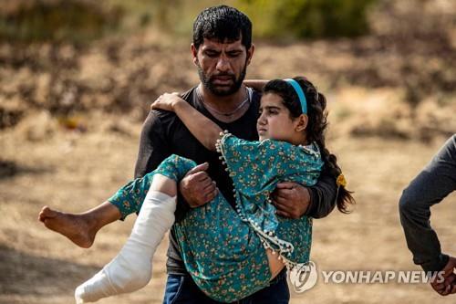 박격포탄에 부상한 시리아 소녀와 아버지
