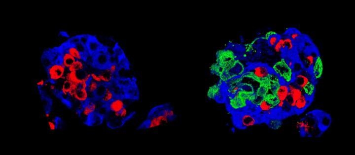 랑게르한스 '슈퍼 섬'(右)의 베타(청색)·알파(홍색) 세포와 양막 상피세포(녹색)