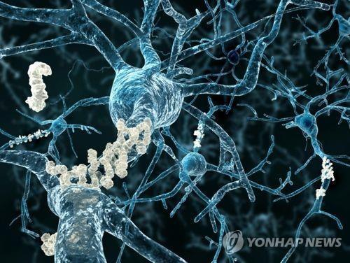 뇌 신경 조직에 침적한 아밀로이드 플라크 이미지