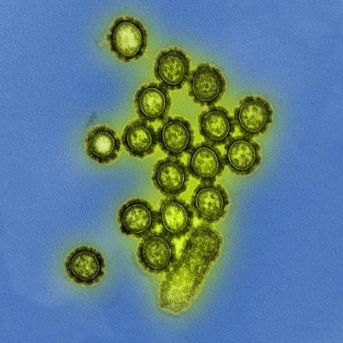 H1N1형 인플루엔자 바이러스