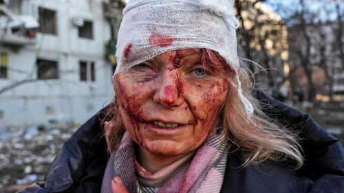 러시아 미사일 공격에서 생존한 우크라이나 교사 올레나 쿠릴로씨