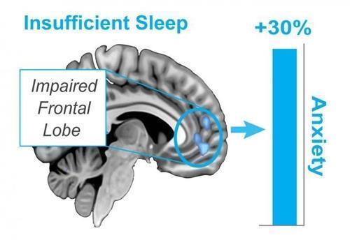 잠이 부족하면 불안증이 심해진다.