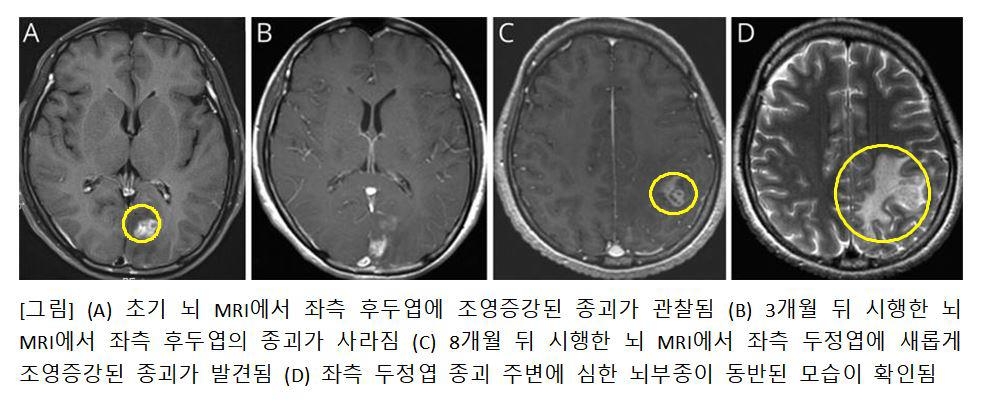 [서울대병원 제공. 재판매 및 DB 금지]