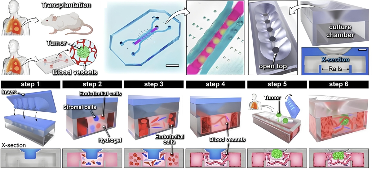 고형암 조직을 이식해 개발한 3차원 미세 칩 모식도