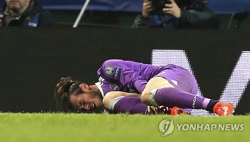 베일이 발목을 잡고 고통스러워하는 모습. [AP=연합뉴스)