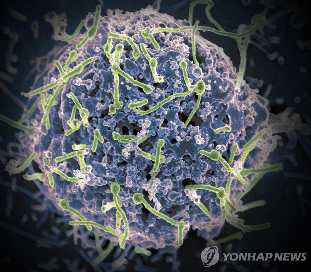 에볼라 바이러스 전자현미경 이미지