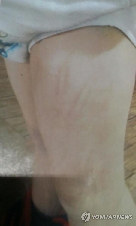 평택 실종아동 학대 흔적