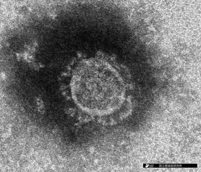 일본 국립감염증연구소가 분리해 낸 신종 코로나바이러스의 전자현미경 사진.[일본 국립감염증연구소 제공, 재판매 및 DB 금지]