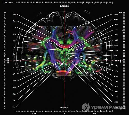 의식은 어떻게 형성될까…'뇌 활성' 패턴 발견