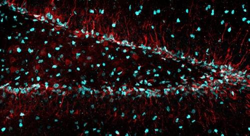 생쥐 뇌 해마 치상회의 신경 줄기세포(형광 부분)