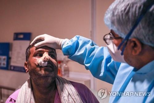 오만에서도 '검은 곰팡이증'…코로나 환자 3명서 확인