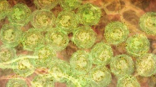 염증 신호를 받아 항체(갈색)를 형성하는 B세포(녹색) 