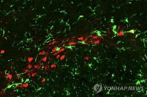중독성 있는 음식을 먹을 때 나오는 신경전달물질 도파민