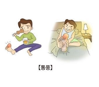 "통풍, 신경 퇴행 질환 위험↑"