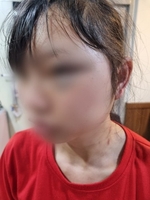 여성 이주노동자 얼굴 발로 걷어찬 40대 징역 2년 구형