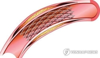 [건강포커스] %22당뇨병 환자, 스텐트 시술 합병증 위험 최대 2배 이상 높아%22