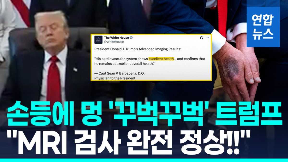 [영상] %22MRI 찍어보니 완전 정상%22…트럼프 '건강 이상설' 일축