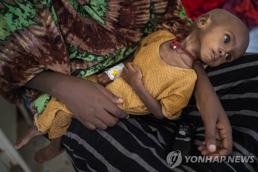 지난 9월 소말리아에서 영양실조로 엄마 품에 안겨 있는 여자 어린이 함디 유수프