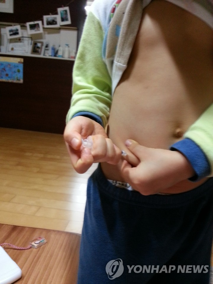 김미영 대표 아들 정소명 군이 4살때 인슐린 주사를 직접 놓는 모습