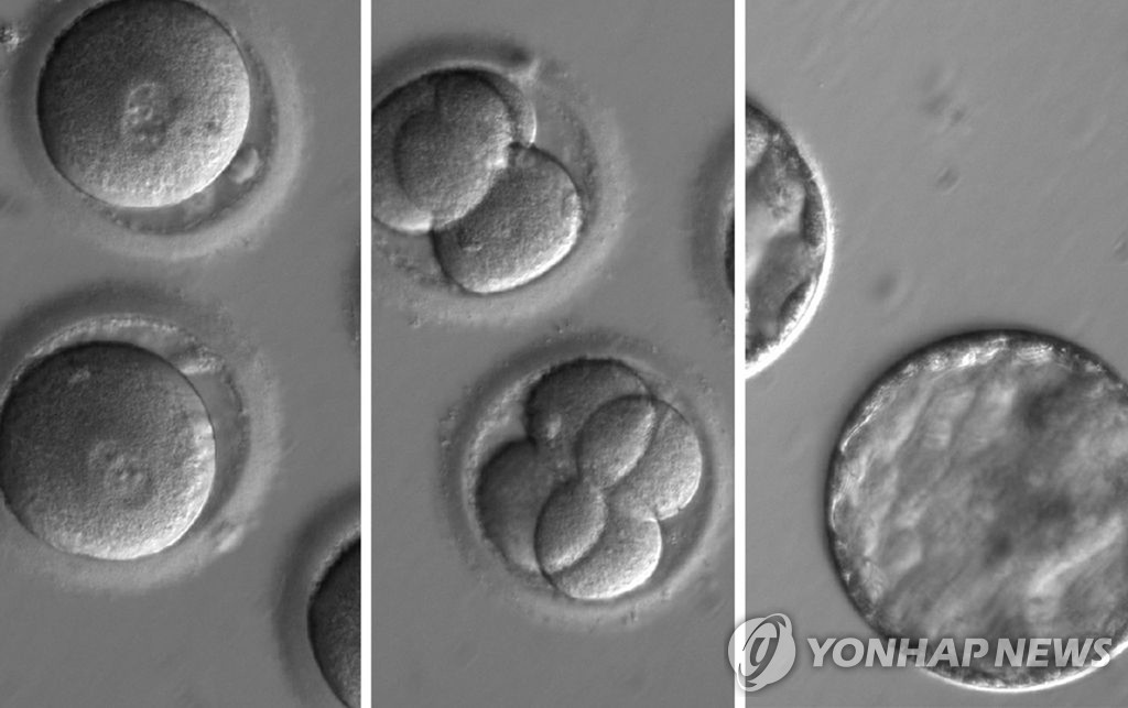 유전 데이터로 아기 선별해 낳는다?…美 스타트업 '슈퍼…